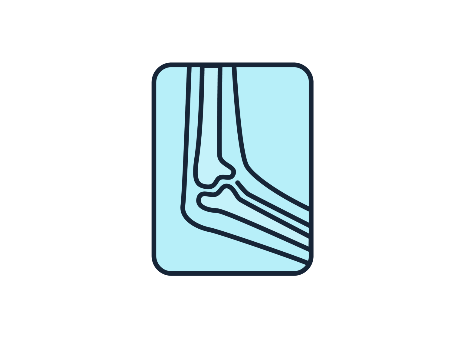 Orthopedics